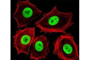 Fluorescent image of MCF-7 cells stained with Cdk4 antibody. (CDK4 抗体  (AA 272-303))