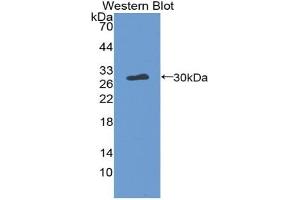 Western blot analysis of the recombinant protein. (Thrombopoietin 抗体  (AA 24-266))