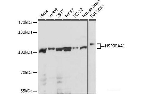 HSP90AA1 抗体