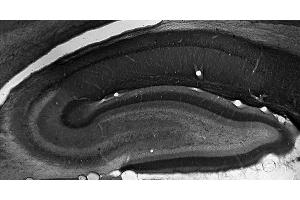 Adult rat hippocampus immunohistochemistry. (Peroxisomal Biogenesis Factor 5-Like (PEX5L) (AA 1-192), (Constant Region) 抗体)