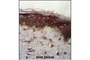 LRRC37B Antibody (C-term) (ABIN657113 and ABIN2846260) immunohistochemistry analysis in formalin fixed and paraffin embedded human skin tissue followed by peroxidase conjugation of the secondary antibody and DAB staining. (LRRC37B 抗体  (C-Term))