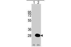 Western blot analysis of HSPB1 (arrow) using HSPB1 polyclonal antibody . (HSP27 抗体  (Ser83))