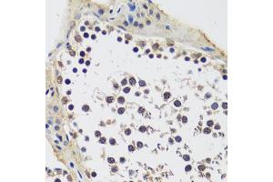 Immunohistochemistry (IHC) image for anti-Coiled-Coil Domain Containing 59 (CCDC59) (AA 1-241) antibody (ABIN7266440)