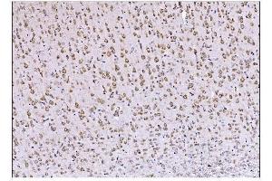 IHC analysis of DLGAP1 using anti-DLGAP1 antibody (ABIN7600257). (DLGAP1 抗体  (AA 17-319))