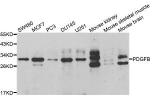 Western blot analysis of extracts of various cell lines, using PDGFB antibody. (PDGFB 抗体  (AA 20-241))