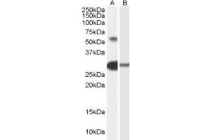 Western Blotting (WB) image for anti-Transcription Factor-Like 5 (Basic Helix-Loop-Helix) (TCFL5) (AA 400-413) antibody (ABIN296838) (TCFL5 抗体  (AA 400-413))