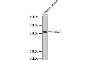 Western blot analysis of extracts of Mouse uterus using HOXC9 Polyclonal Antibody at dilution of 1:1000. (HOXC9 抗体)