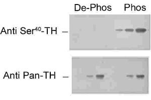 Immunohistochemical staining of retina with the pan-tyrosine hydroxylase (pan-TH) and phospho-specific tyrosine hydroxylase (phospho-TH) antibodies. (Tyrosine Hydroxylase 抗体  (pSer40))
