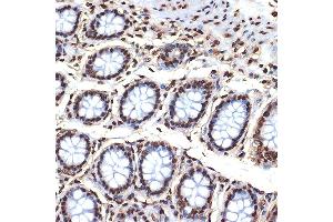 Immunohistochemistry of paraffin-embedded human colon using Histone H4 Rabbit mAb (ABIN7267706) at dilution of 1:100 (40x lens). (HIST4H4 抗体)