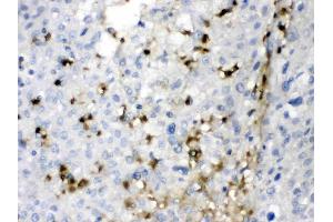 IHC analysis of CA2 using anti- CA2 antibody . (CA2 抗体  (AA 2-260))