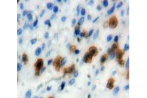 Used in DAB staining on fromalin fixed paraffin-embedded Spleen tissue (IRF4 抗体  (AA 175-433))