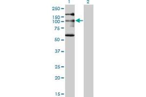 Western Blot analysis of NBR1 expression in transfected 293T cell line by NBR1 monoclonal antibody (M05), clone 5C3. (NBR1 抗体  (AA 2-96))