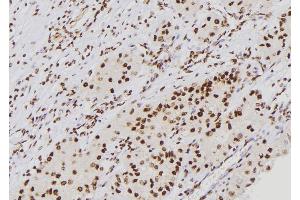 ABIN6276688 at 1/100 staining Human kidney tissue by IHC-P. (p21 抗体  (Internal Region))