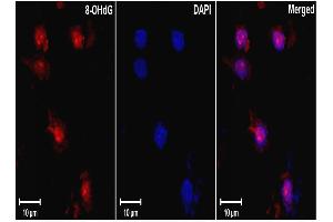 DNARNA Damage (15A3), ischemic rat brain tissue. (DNA Damage 抗体)