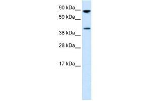 WB Suggested Anti-ETV4 Antibody Titration: 0. (ETV4 抗体  (Middle Region))