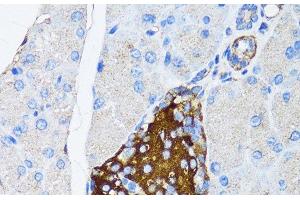 Immunohistochemistry of paraffin-embedded Mouse pancreatic islet using TIMP2 Polyclonal Antibody at dilution of 1:150 (40x lens). (TIMP2 抗体)