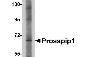 Western blot analysis of Prosapip1 in SK-N-SH cell lysate with Prosapip1 antibody at 1 µg/mL. (ProSAPiP1 抗体  (C-Term))