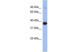 WB Suggested Anti-MPP3 Antibody Titration: 0. (MPP3 抗体  (Middle Region))