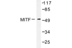 Image no. 1 for anti-Microphthalmia-Associated Transcription Factor (MITF) antibody (ABIN272035) (MITF 抗体)