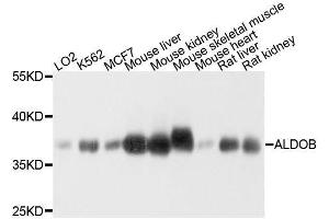 Western blot analysis of extracts of various cell lines, using ALDOB antibody. (ALDOB 抗体  (AA 1-200))
