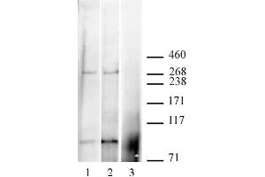 CABIN1 antibody (pAb) tested by Immunoprecipitation / Western blot. (CABIN1 抗体  (C-Term))