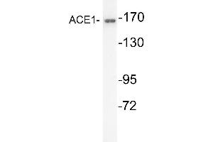 Western blot (WB) analysis of ACE1 antibody in extracts from mouse kidney cells. (Angiotensin I Converting Enzyme 1 抗体)