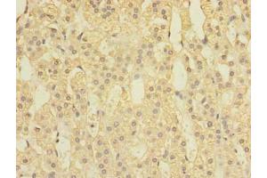 Immunohistochemistry (IHC) image for anti-Speckle-Type POZ Protein (SPOP-B) (AA 48-374) antibody (ABIN7170432)