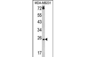 Western blot analysis of LTA Antibody (Center) (ABIN652448 and ABIN2842303) in MDA-M cell line lysates (35 μg/lane). (LTA 抗体  (AA 46-72))