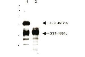 Western blot analysis using anti-p33 ING1 antibody to detect over expressed Human ING1 present in cell nuclear extracts. (ING1 抗体  (AA 285-296))
