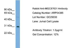 WB Suggested Anti-MGC87631  Antibody Titration: 0. (MGC87631 (Middle Region) 抗体)
