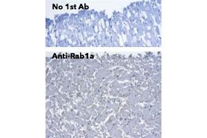Immunohistochemistry (IHC) image for anti-RAB1A, Member RAS Oncogene Family (RAB1A) (C-Term) antibody (ABIN7272978) (RAB1A 抗体  (C-Term))