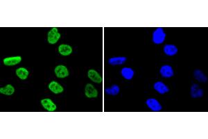 PC-3 cells were stained with MSK1 (Ser376) (11A1) Monoclonal Antibody  at [1:200] incubated overnight at 4C, followed by secondary antibody incubation, DAPI staining of the nuclei and detection. (MSK1 抗体  (pSer376))