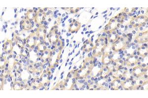 Detection of IFNa7 in Mouse Kidney Tissue using Polyclonal Antibody to Interferon Alpha 7 (IFNa7)