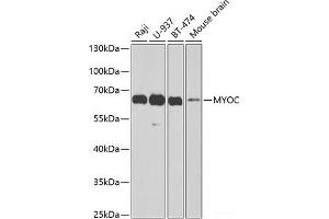 Western blot analysis of extracts of various cell lines using MYOC Polyclonal Antibody at dilution of 1:1000. (MYOC 抗体)