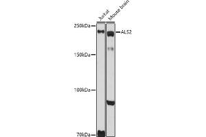 Western blot analysis of extracts of various cell lines, using  antibody (ABIN6131182, ABIN6136830, ABIN6136831 and ABIN6222940) at 1:1000 dilution. (ALS2 抗体  (AA 1-280))