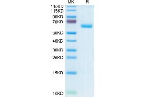 Human CLEC-1 on Tris-Bis PAGE under reduced condition. (CLEC1A Protein (AA 74-280) (Fc Tag))