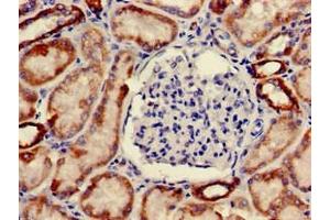 Immunohistochemistry of paraffin-embedded human kidney tissue using ABIN7162222 at dilution of 1:100 (ONECUT2 抗体  (AA 214-331))