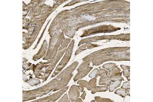 IHC analysis of NDUFB10 using anti-NDUFB10 antibody (ABIN7601461).