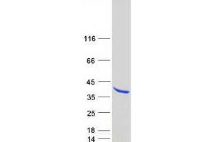 Validation with Western Blot