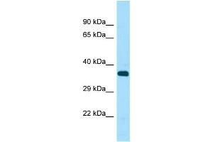 Western Blotting (WB) image for anti-serine/threonine Kinase 33 (STK33) (C-Term) antibody (ABIN2506070) (STK33 抗体  (C-Term))