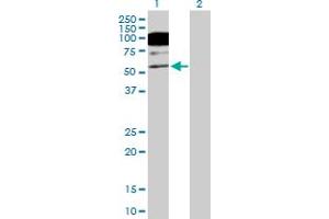 Western Blot analysis of CACNB1 expression in transfected 293T cell line by CACNB1 MaxPab polyclonal antibody. (CACNB1 抗体  (AA 1-598))