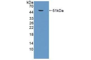 Western Blotting (WB) image for anti-Surfactant Protein C (SFTPC) (AA 1-193) antibody (ABIN7443620)