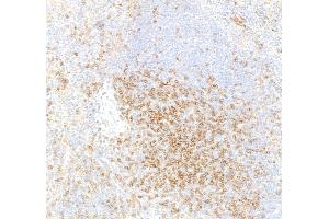 Immunohistochemistry (IHC) image for anti-CD4 (CD4) (AA 407-457) antibody (ABIN7453902) (Recombinant CD4 抗体  (AA 407-457))