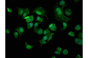 Immunofluorescence staining of MCF-7 cells with ABIN7148907 at 1:400, counter-stained with DAPI. (p21 抗体  (AA 2-164))