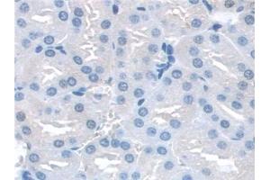 Detection of SNAP23 in Mouse Kidney Tissue using Polyclonal Antibody to Synaptosomal Associated Protein 23 kDa (SNAP23) (SNAP23 抗体  (AA 1-210))