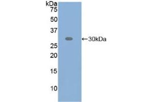 Western blot analysis of recombinant Human ATF6. (ATF6 抗体  (AA 423-646))