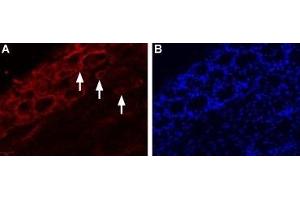 Expression of TRPV4 in rat DRG - Immunohistochemical staining of rat dorsal root ganglia (DRG) frozen sections with Anti-TRPV4-ATTO Fluor-550 Antibody (ABIN7043851), (1:20).