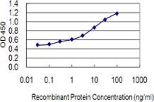 Detection limit for recombinant GST tagged LSM4 is 0. (LSM4 抗体  (AA 1-73))