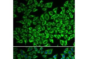 Immunofluorescence analysis of A549 cells using IL12RB1 Polyclonal Antibody (IL12RB1 抗体)