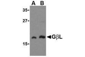 Western blot analysis of GbL in human brain cell lysate with AP30359PU-N GbL antibody at (A) 1 and (B) 2 μg/ml. (GBL 抗体)